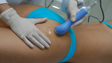 Ultrasonic Cavitation